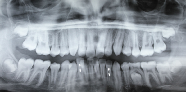 aus-case-report-ortho-xray