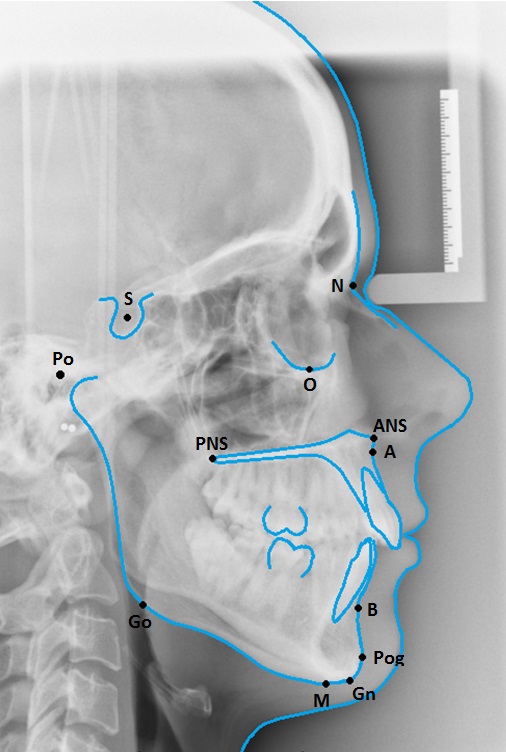 Cephalometrics2